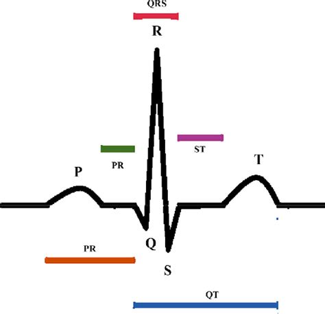 Components Of Ecg Signals Download Scientific Diagram