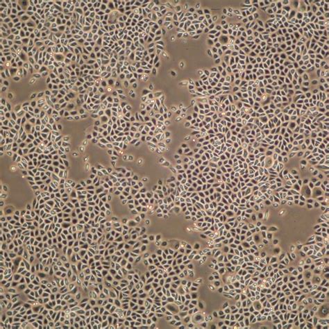 Primary Human Keratinocytes Growing In Cnt Pr Medium Day 5 After Seeding