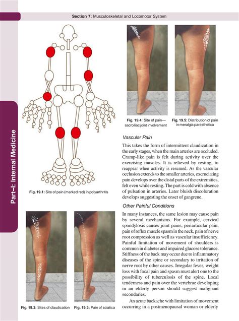 SOLUTION Examination Of The Musculoskeletal System Studypool