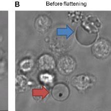 Fig S2 Antibody Mediated Depletion Of Human NK Cells And