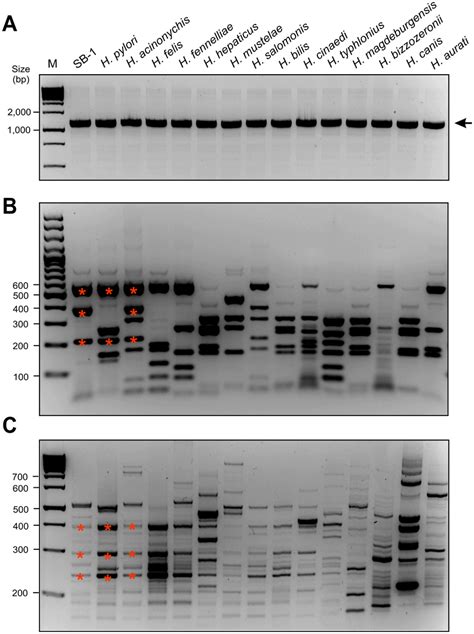 Analysis Of 16s Rrna By Pcr Rflp And Rapd Fingerprinting Of Different