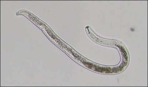 Lesion Nematode In Potato Nc State Extension Publications