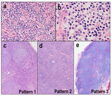 Diagnostics Free Full Text Pathological And Molecular Features Of