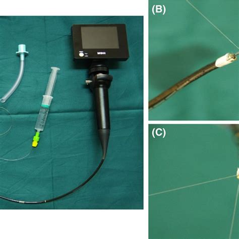 Images Showed The Anesthesiologist Sprayed 2 Lidocaine Via An Epidural