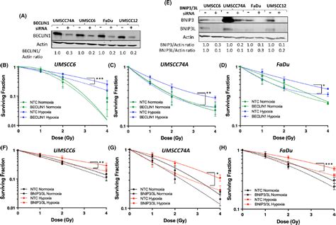 Autophagy Is The Main Driver Of Radioresistance Of Hnscc Cells In Mild