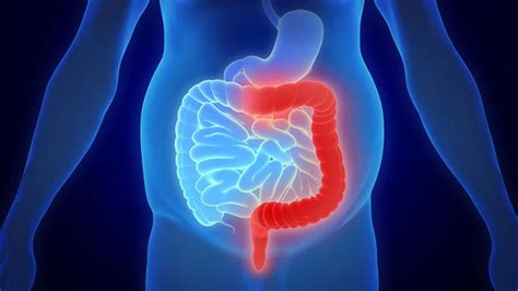 Qu Es La Colitis Ulcerosa S Ntomas Causas Y C Mo Tratar La Enfermedad