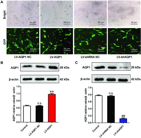 Efficiency Of Lentivirus Mediated AQP1 Overexpression Or Silencing In