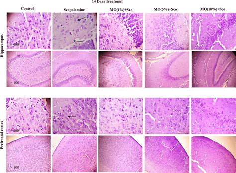 Photomicrograph of the hippocampus and prefrontal cortex stained with ... 