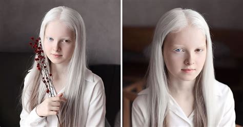 Photographer Captured The Ethereal Portraits Of Beautiful Girl With Albinism And Heterochromia