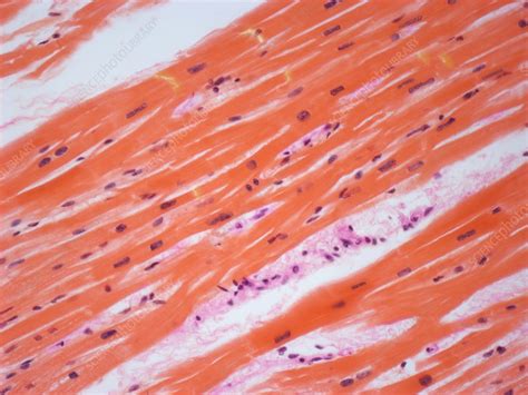 Human Cardiac Muscle Light Micrograph Stock Image C