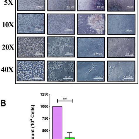 Effect Of Ultrasound On Jurkat Cells A 10 6 Jurkat Cellsml Were