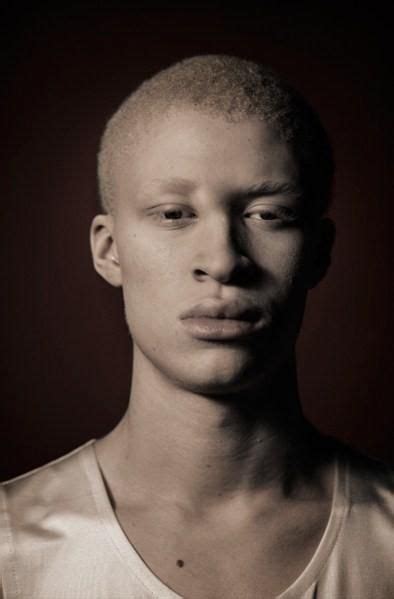 Albino Male Model Shaun Ross | Albino model, Shaun ross, Albino men