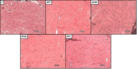 Cross Sectional Image Of The EDL Muscle Magnification 100x 100 Mm