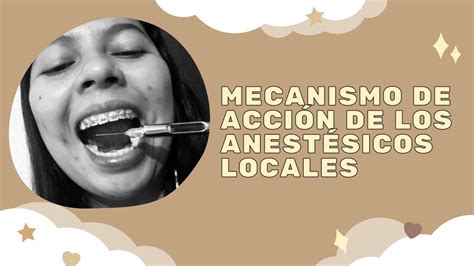 Mecanismo de acción de los anestésicos locales en odontologia Me