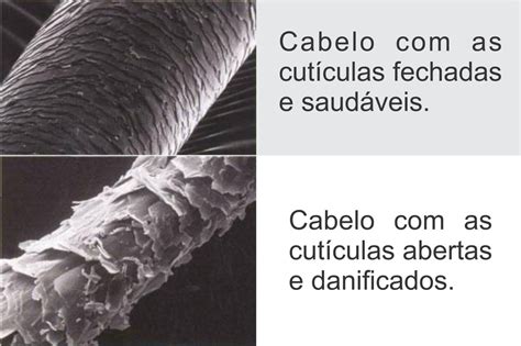 Quantos Fio De Cabelo Um Ser Humano Tem