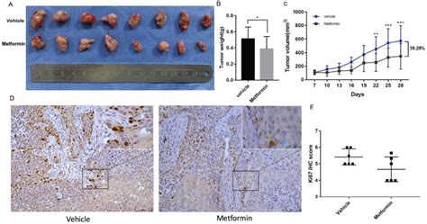 Metformin Inhibited OSCC Tumor Growth In Nude Mice A Macroscopic