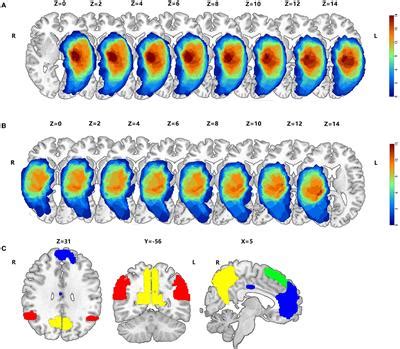 Frontiers Synergistic Structural And Functional Alterations In The