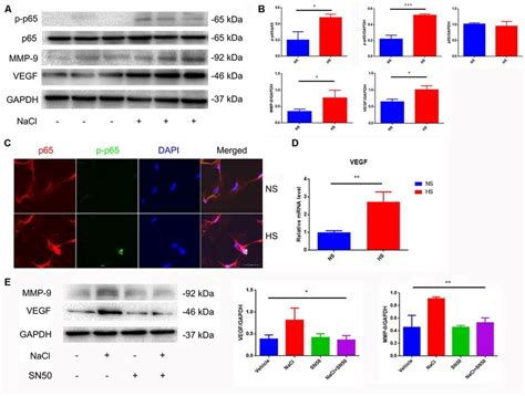 Increased Expression Of Vegf Is Mediated By Nfκbmmp 9 Pathway A B