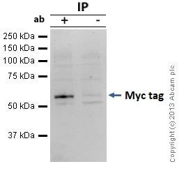 Anti Myc Tag Antibody E Ab Abcam