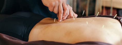 Pain Relief Acupuncture Clinic In Surrey BC Vital Physio