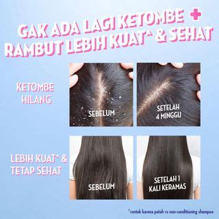 Jual Sunsilk Shampo Anti Ketombe Rambut Sehat Dan Kuat Anti Dandruff