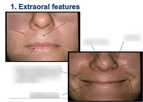 Oral Anatomy Extraoral Features Diagram Quizlet