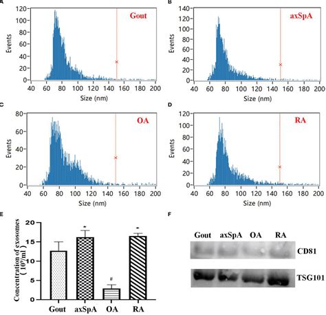 Figure 1 From TMT Based Quantitative Proteomics Analysis Of Synovial