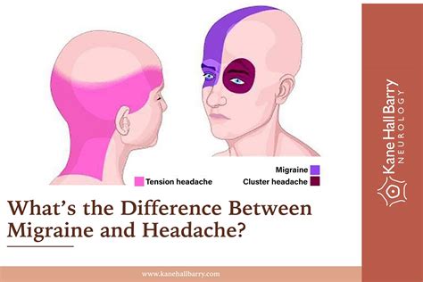 Understanding The Difference Between Migraines And Headaches Kane