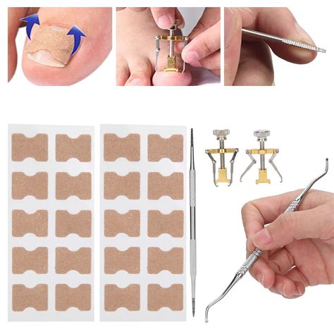 Ingrown Nail Correction Ingrown Toenail Correction Tool Kit Paronychia Toe Nail Fixer Pedicure