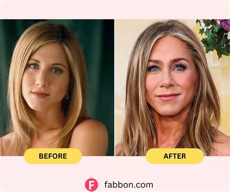 Jennifer Aniston Plastic Surgery Secrets Before And After Photos Fabbon