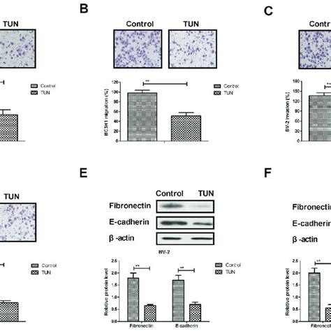 Effects of TUN treatment on glioma cell migration and invasion. Cells ... 
