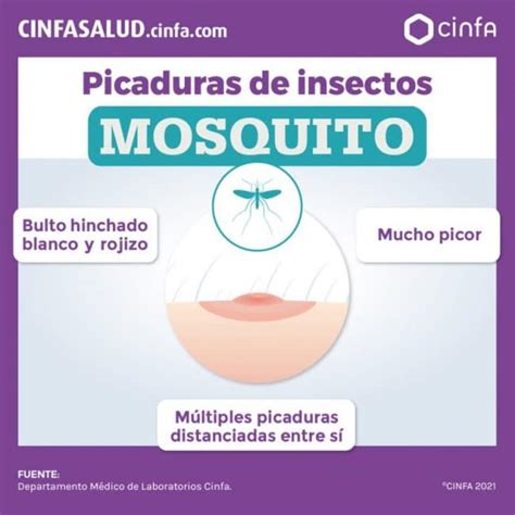 Cómo Curar Las Picaduras De Mosquitos MiBBmemima