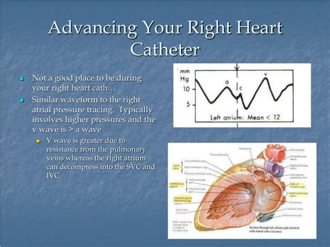 Ppt Right Heart Catheterization Basic Right Heart Pressure Tracings Powerpoint Presentation