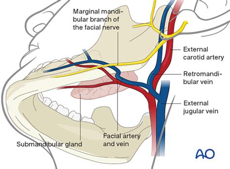 Submandibular Approach