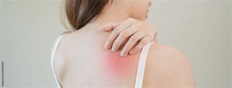 Sensitive skin allergic concept, Woman itching on her back have a red ...