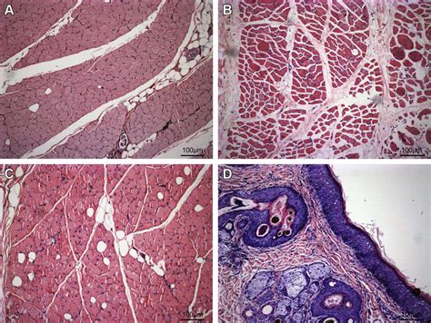 Histologic Structure Of The Neo Phalli Hematoxylin And Eosin Stain