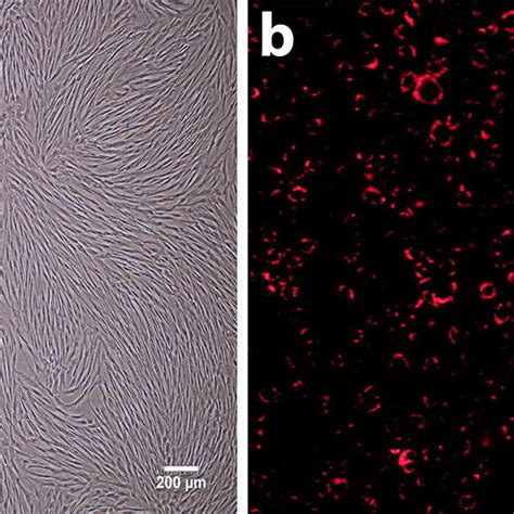 Phase Contrast Image Of Cell Morphology A Human Adipose Derived Stem