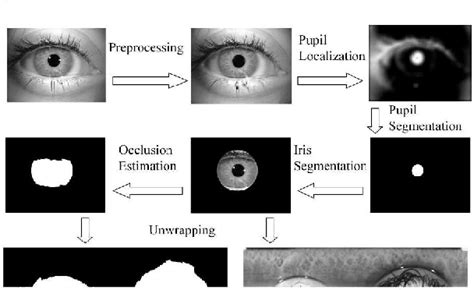 Figure 1 From A Robust Iris Segmentation Procedure For Unconstrained