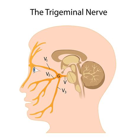 Sphenopalatine Ganglion Block - Ainsworth Institute