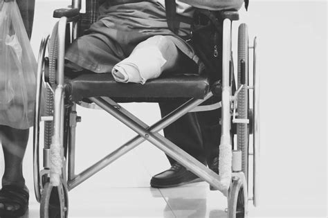 Amputation And Loss Of Limb Accidents Aramjoo Law Firm