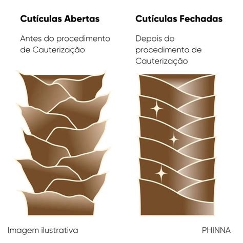 Cauteriza O Capilar Para Que Serve E Como Feita