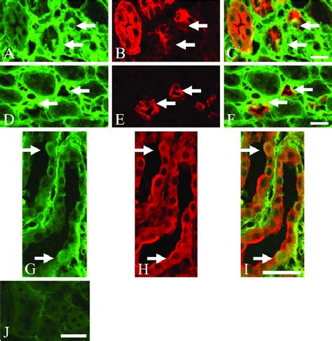 Double Immunofluorescence Staining For Twist And Anti Aquaporin