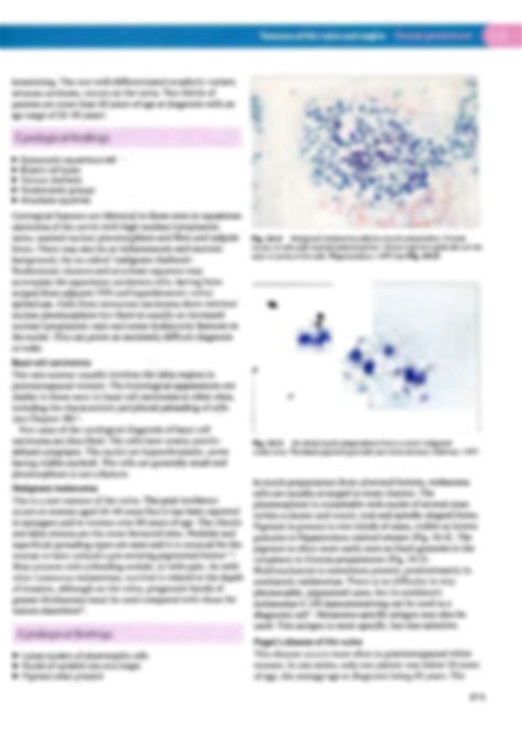 SOLUTION Tumours Of The Vulva Vagina Studypool