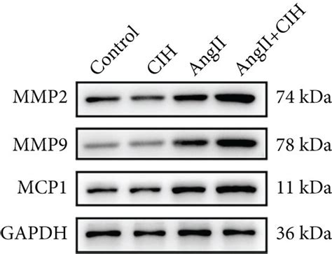 Cih Upregulates Mmp Expression And Mtros Generation In Vitro The