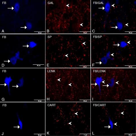 A Fb Labeled Neurons Arrows In The Porcine Control Dmx B Gal Ir