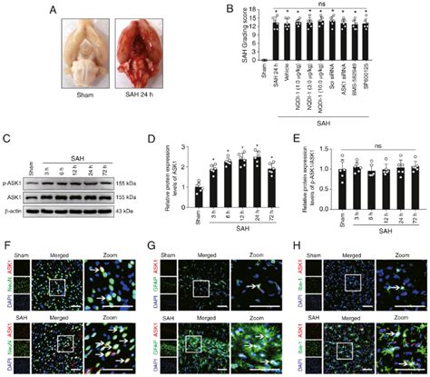 Expression Changes And Cellular Localization Of Ask In Rat Brain