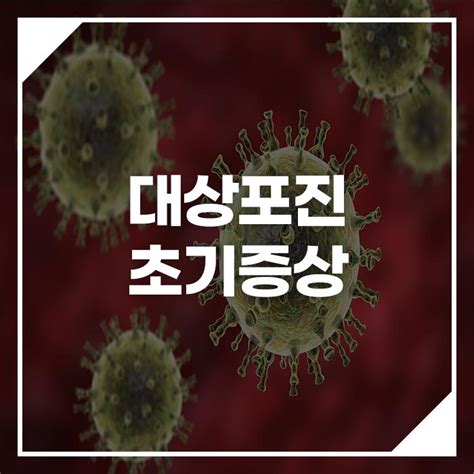 대상포진초기증상 및 원인과 치료방법 네이버 블로그