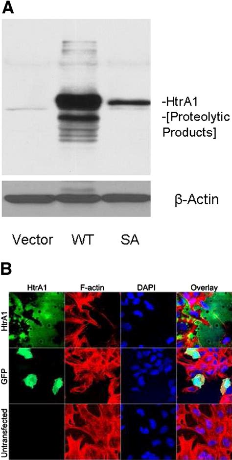 Elevated Expression Of Serine Protease Htra In Preeclampsia And Its