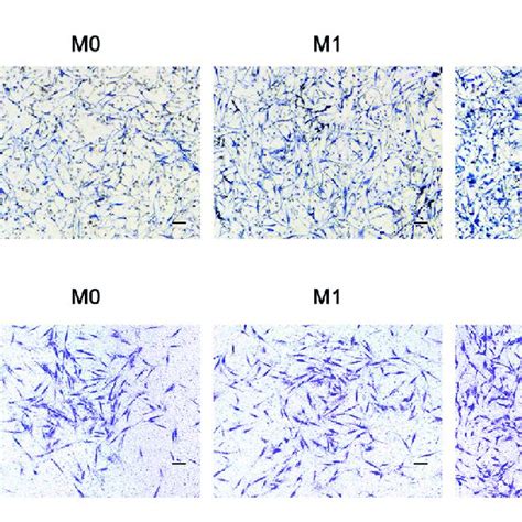 Chemotaxis Of Adipose Derived Mesenchymal Stem Cells Under The Download Scientific Diagram