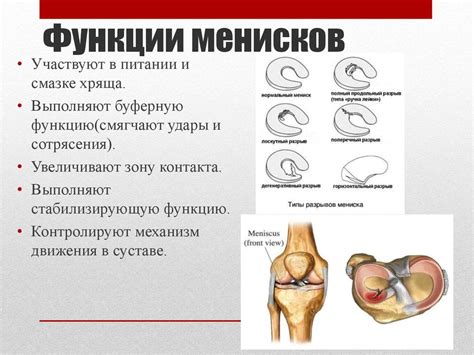 Повреждение мениска коленного сустава. Симптомы, лечение и профилактика